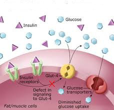 mekanisme diabetes